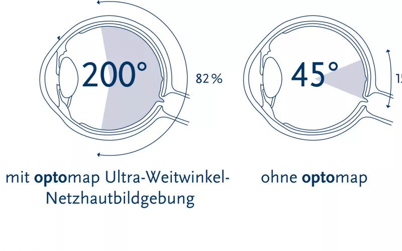 Laserscanning der Netzhaut Augentagesklinik Stoll